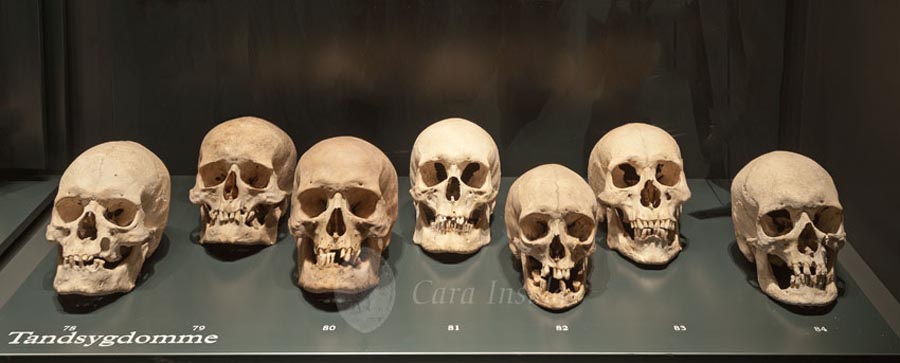 DSC_6561-Skeletgavl